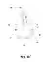 Fig. 16 - Elbow orthosis