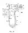 Fig. 02 - Fluid input module for multi-lumen catheters