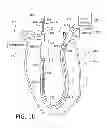 Fig. 05 - Fluid input module for multi-lumen catheters