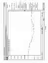 Fig. 152 - Infusion pump assembly