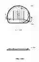 Fig. 158 - Infusion pump assembly