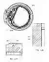 Fig. 166 - Infusion pump assembly