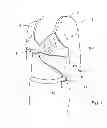 Fig. 02 - Bra With Integrated Breast Pump