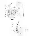 Fig. 03 - Bra With Integrated Breast Pump