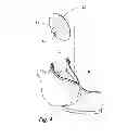 Fig. 04 - Bra With Integrated Breast Pump