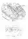 Fig. 02 - Fluid delivery device, transcutaneous access tool and insertion mechanism for use therewith