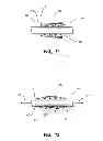 Fig. 07 - Catheter assembly, catheter systems including same, and method of manufacture