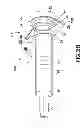 Fig. 04 - Syringe assembly having a flexible or a slidable flange