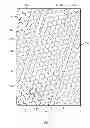 Fig. 02 - MOIST DRESSING WITH HONEYCOMB PATTERN AND DRAIN CHANNELS