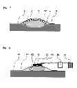 Fig. 04 - Method for vacuum therapy of wounds