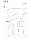 Fig. 04 - Body adhering absorbent article