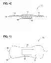 Fig. 34 - Body adhering absorbent article