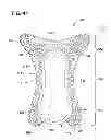 Fig. 35 - Body adhering absorbent article