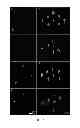 Fig. 08 - Mechanically robust fast-dissolving microneedles for transdermal drug and vaccine delivery