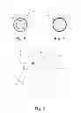 Fig. 05 - Low-profile intravenous catheter device