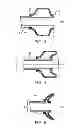 Fig. 04 - Hemostasis-enhancing device and method for its use