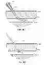 Fig. 07 - Hemostasis-enhancing device and method for its use