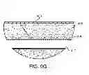 Fig. 12 - Hemostasis-enhancing device and method for its use