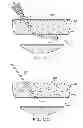 Fig. 20 - Hemostasis-enhancing device and method for its use