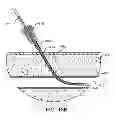 Fig. 24 - Hemostasis-enhancing device and method for its use
