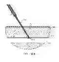 Fig. 27 - Hemostasis-enhancing device and method for its use