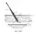 Fig. 28 - Hemostasis-enhancing device and method for its use