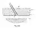 Fig. 30 - Hemostasis-enhancing device and method for its use