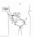Fig. 01 - Urgency therapy with neuromodulation and C-afferent nerve desensitization