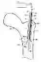 Fig. 01 - Multichannel cannula and methods for using same