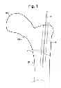 Fig. 02 - Multichannel cannula and methods for using same