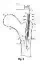 Fig. 05 - Multichannel cannula and methods for using same