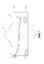 Fig. 02 - Catheter in bag without additional packaging