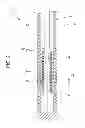 Fig. 03 - GUIDEWIRE