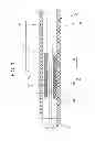 Fig. 04 - GUIDEWIRE