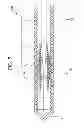 Fig. 06 - GUIDEWIRE