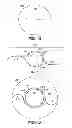 Fig. 07 - Method for creating incision to improve intraocular lens placement