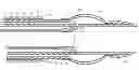Fig. 01 - Apparatus and methods for retracting a catheter balloon