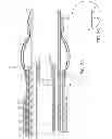 Fig. 04 - Apparatus and methods for retracting a catheter balloon