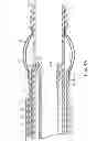 Fig. 06 - Apparatus and methods for retracting a catheter balloon