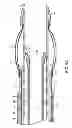 Fig. 08 - Apparatus and methods for retracting a catheter balloon