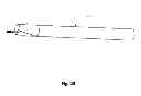 Fig. 16 - Ophthalmic surgical device for capsulotomy