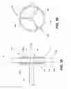 Fig. 16 - ABLATION THERAPY SYSTEM AND METHOD FOR TREATING CONTINUOUS ATRIAL FIBRILLATION