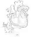 Fig. 06 - Magnetically coupling devices for mapping and/or ablating