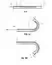 Fig. 08 - Magnetically coupling devices for mapping and/or ablating