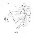 Fig. 13 - Magnetically coupling devices for mapping and/or ablating