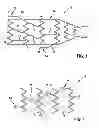 Fig. 03 - HIGH-FREQUENCY APPLICATION DEVICE FOR VASCULAR USE, IN PARTICULAR FOR APPLICATION OF HIGH-FREQUENCY ENERGY TO THE RENAL ARTERIAL WALL