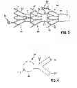 Fig. 04 - HIGH-FREQUENCY APPLICATION DEVICE FOR VASCULAR USE, IN PARTICULAR FOR APPLICATION OF HIGH-FREQUENCY ENERGY TO THE RENAL ARTERIAL WALL