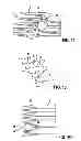 Fig. 07 - HIGH-FREQUENCY APPLICATION DEVICE FOR VASCULAR USE, IN PARTICULAR FOR APPLICATION OF HIGH-FREQUENCY ENERGY TO THE RENAL ARTERIAL WALL