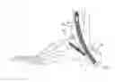 Fig. 01 - Bone nail for the heel