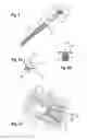 Fig. 05 - Bone nail for the heel
